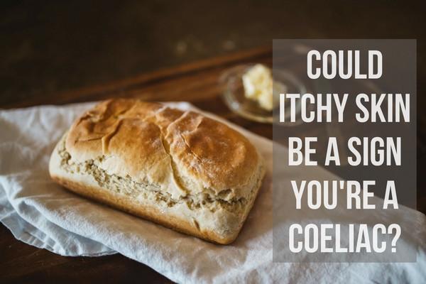 Could itchy skin be a sign you're a coeliac?