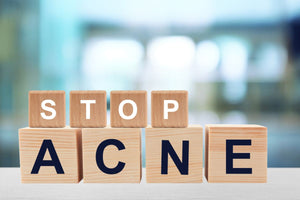How to Get Rid of Acne Skincare Routine