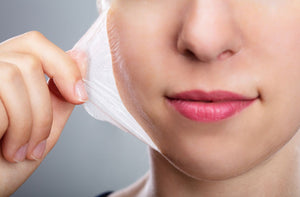 Chemical peels and acne