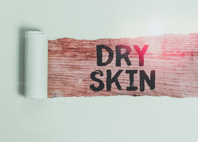 How to Treat Dry Skin with Acne 